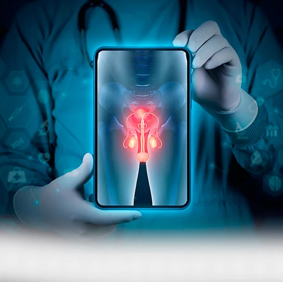 Cáncer de Próstata